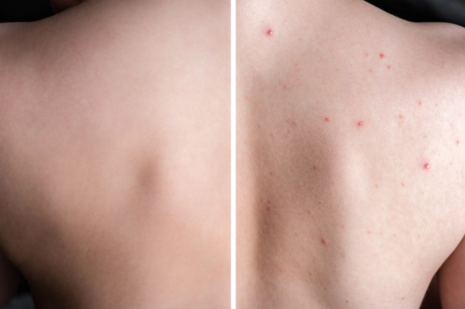 Skin Control